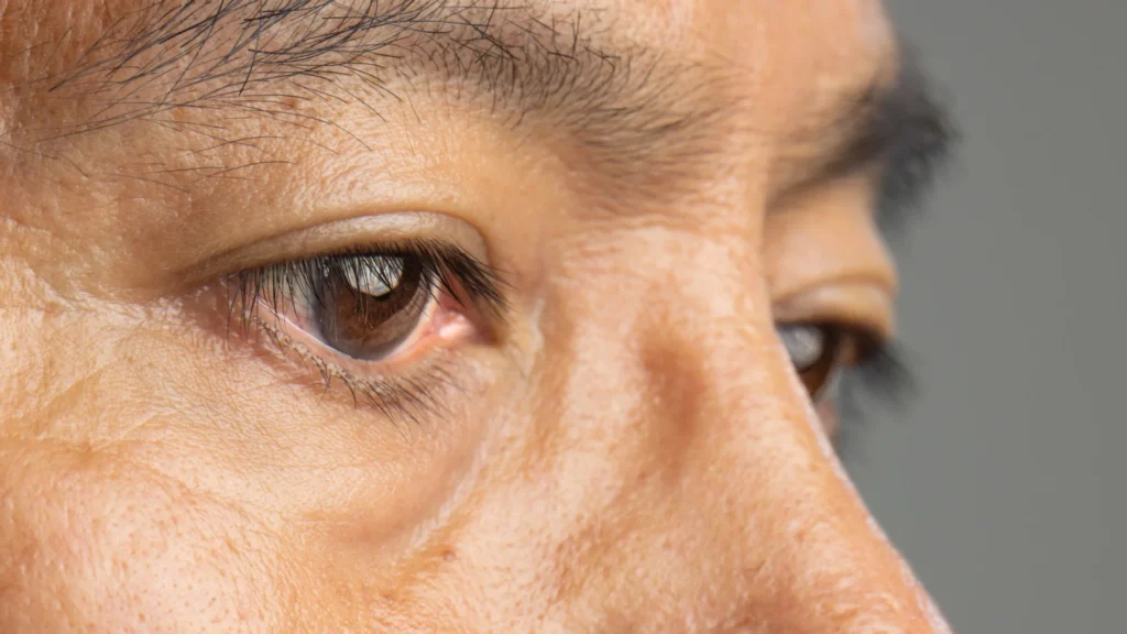 cataracts, cataract surgery, eye health, vision problems, blurred vision, cloudy vision, treatment for cataracts, causes of cataracts, symptoms of cataracts, eye care, healthy aging